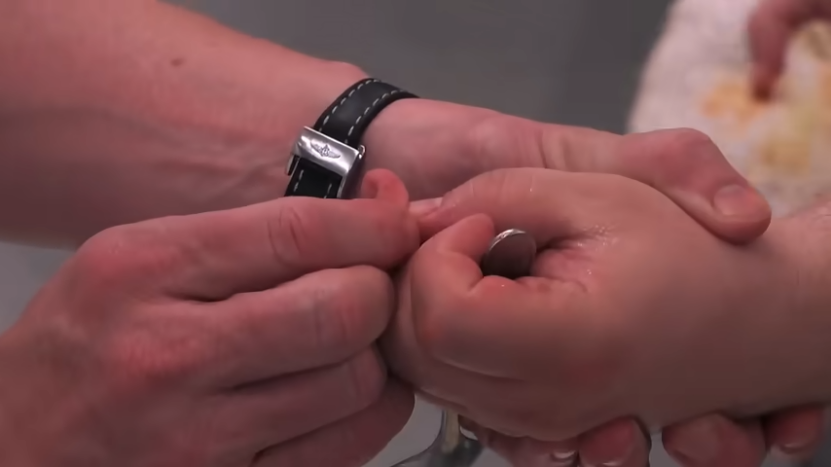 A Close-Up Image of A Person Examining Another Person's Injured Thumb in A Kitchen Setting